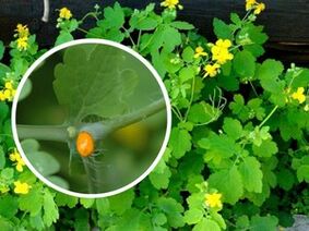 plantar siğillerin tedavisi için kırlangıçotu otu suyu
